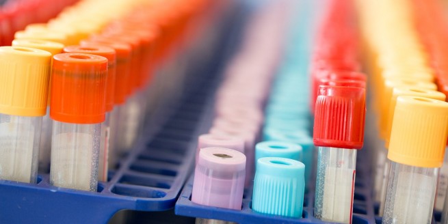 Lab Values Interpretation Part 1: Electrolytes and Renal Function image