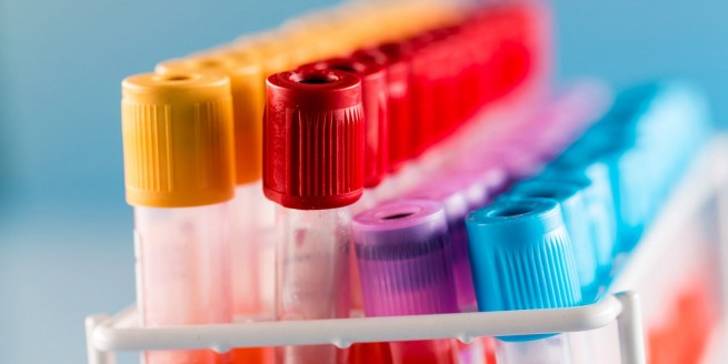 Lab Values Interpretation Part 2: CBC , Coags, TFT, LFT, Cardiac Markers and more... image