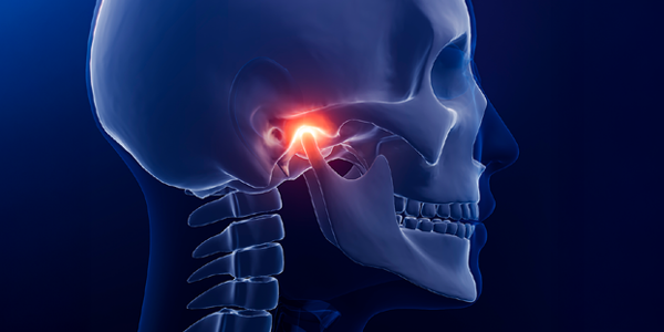 Temporomandibular Joint Dysfunction - A Multidisciplinary Approach to Care image