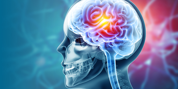 Brain Injury Rehabilitation Across the Continuum: Live Webinar Session #1 - H.I.T It: Applying High-Intensity Principles to Optimize Brain Injury Outcomes image